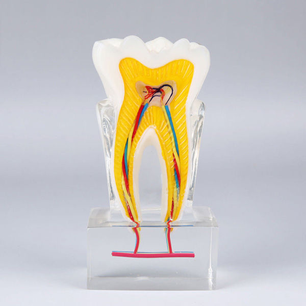 Dental 6 times Tooth nerve Disfection plastic teeth model communication model