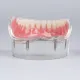 Details about  Dental implant restoration model with clear red gingival 4 pcs implants