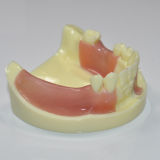Dental absence of different teeth implant teeth model can exercise cut implant