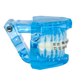 Dental orthodontic teach study teeth model mental and ceramic bracket contrust