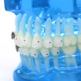 Dental orthodontic teach study teeth model mental and ceramic bracket contrust