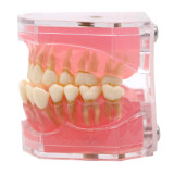 Dental standard orthodontic plastic teeth model 4004 with 28 removeable teeth
