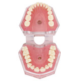 Dental standard orthodontic plastic teeth model 4004 with 28 removeable teeth