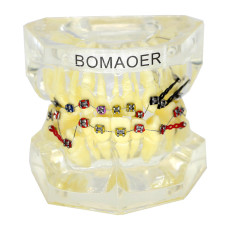 Dental plastic teeth study model with elastic bands bracket and elastic chain