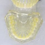 Plastic Study Teeth Model Demonstrate Comprehensive Repair Yellow Transparent