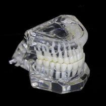 Plastic Study Teeth Model Demonstrate Comprehensive Repair Yellow Transparent