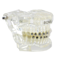Dental orthodontic lab Plastic Study Teeth Model and ceramic bracket contrust