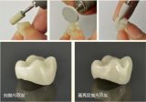 8PCS/KIT Dental Preparation Kit Porcelain Alloy Inlay and onlay FG0908D